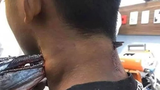Denizden fırladı ensesine saplandı !