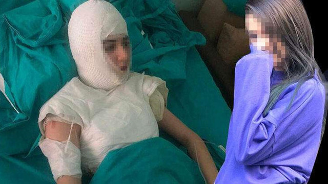 uvey kizini sicak suyla haslayan