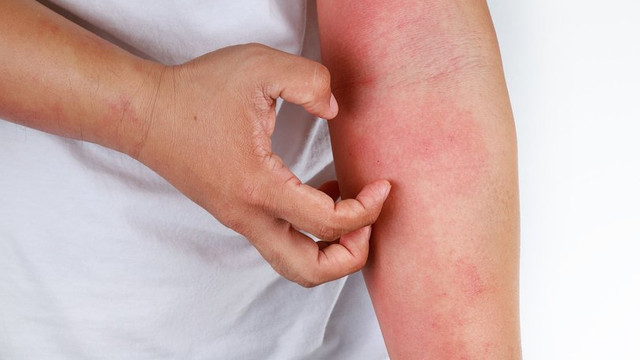 bu belirtiler varsa dikkat istanbul da