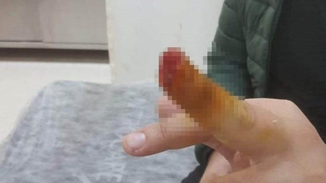 Güvenlik görevlisinin parmağını ısırarak kopardı!