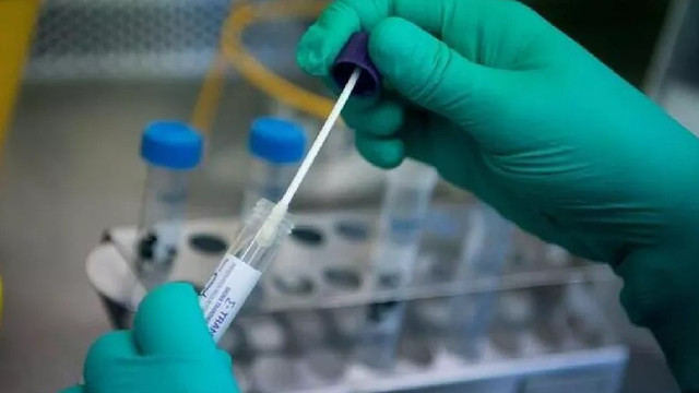 Koronavirüs test ücretleri nasıl geri alınacak? İşte yapmanız gerekenler