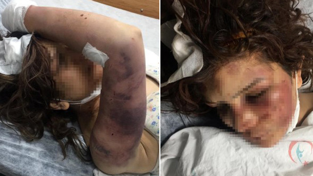 Eşine günlerce işkence yapmıştı! Kan donduran detaylar