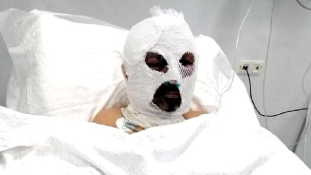 Şoförün üzerine tiner döküp yakan kadın tutuklandı !