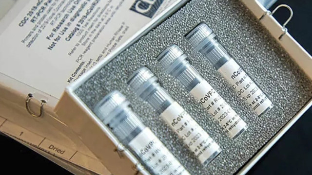 Ankara Üniversitesi'nde koronavirüs testlerine başlandı