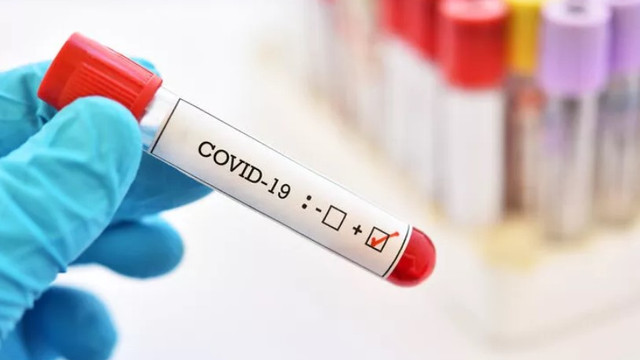 Koronavirüs teşhisinde yeni umut: COVID-Net