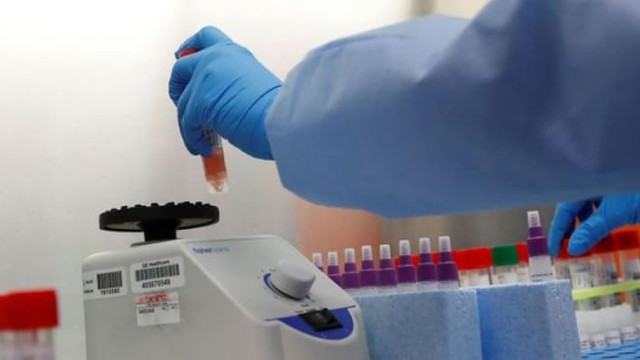 ''Bu test sayılarıyla vakaları yakalamak mümkün değil''