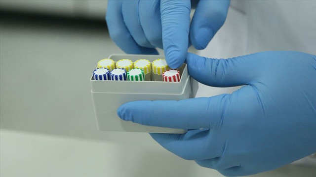 ABD merkezli şirket geliştirdi ! 2 dakikada sonuç veren teste onay