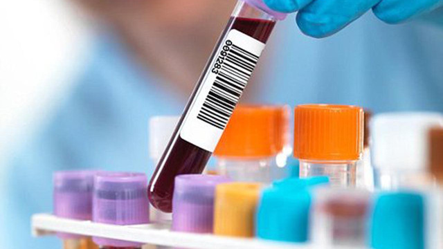 Negatif testlerin yüzde 30’u için ''hata var'' iddiası!