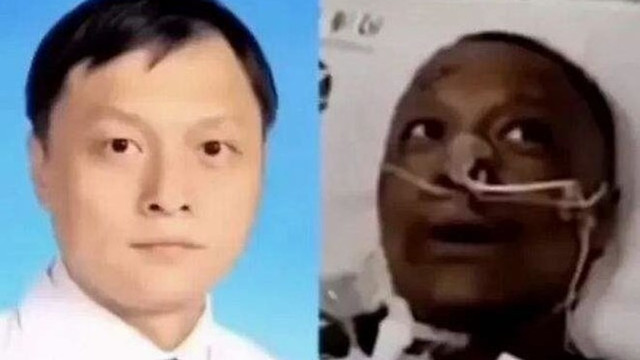 Koronavirüs nedeniyle ten rengi değişen doktor hayatını kaybetti