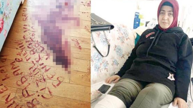 Öleceğini düşünüp saldırganın ismini kendi kanıyla yazan kadın konuştu