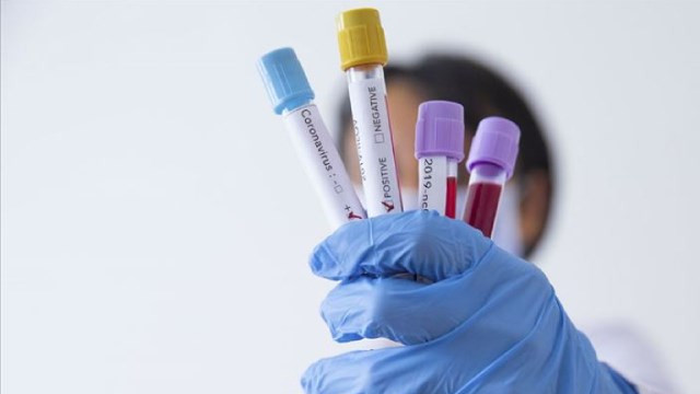 Türkiye’den gelen yolculara çifte PCR testi yapılacak!
