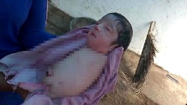 100 binde bir görülüyor! Kolsuz ve bacaksız doğdu