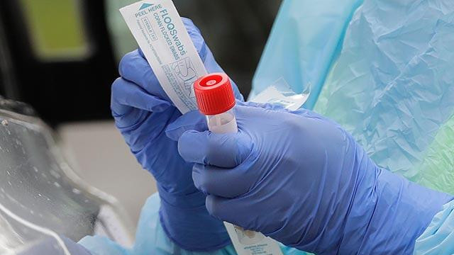 Dünya genelinde koronavirüsten kaç kişi öldü?