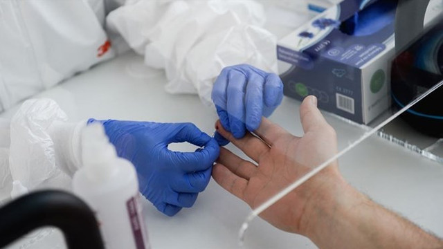 Koronavirüsü 30 saniyede tespit edebilen test geliştirildi