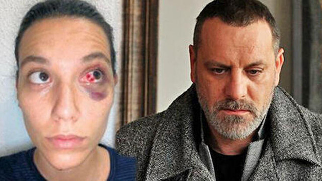 Deniz Bulutsuz'un darp raporu ortaya çıktı