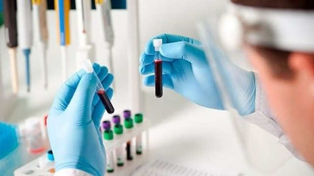 Koronavirüs testi için olay sözler: ''Yazı-tura atsanız daha iyi''