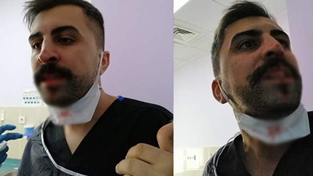 Ağrı'da sosyal mesafe uyarısı yapan hemşirenin burnunu kırdılar