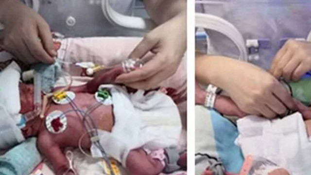Çin'de mucize olay! Üç kez düşük yaptıktan sonra, dördüz doğurdu!