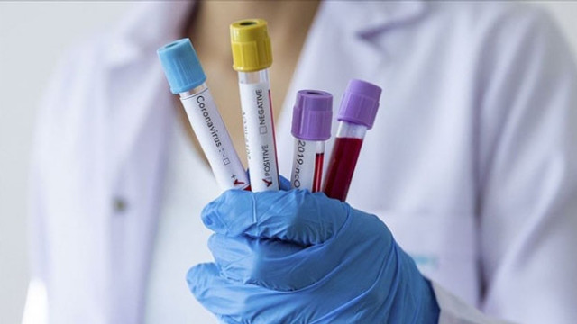 Türk Tabipleri Birliği'nden ''Temaslılara test yapılsın'' çağrısı