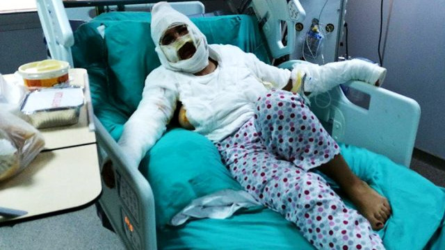 Üzerine kızgın yağ döken caniyi affetti: ''Bırakın onu''
