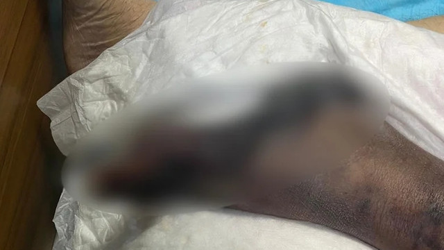 ''A''normalleşenler bu fotoğrafa iyi baksın! Başhekim paylaştı...