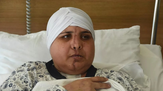 İkiye ayrılan yüzü, 10 saatlik ameliyatla birleştirildi