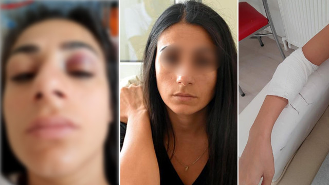 Gözü dönmüş sapık sokak ortasında saldırdı! Hem taciz, hem darp!