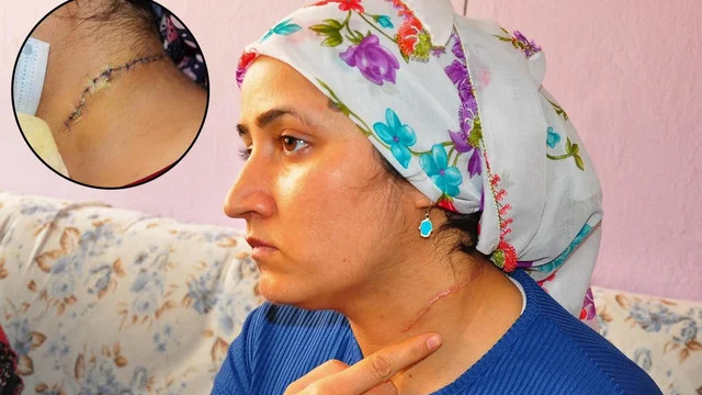 Dehşet olay! Boşanmak istediği eşi boğaznıı falçatayla kesti