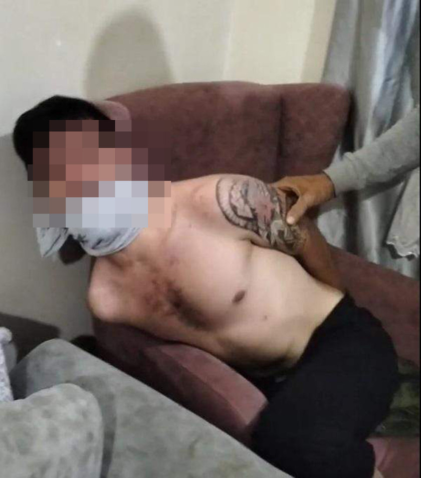 Balıkesir'de 25 yaşındaki bir genci ellerini ve ağzını bağlayarak işkence eden ve görüntülerini de sosyal medyadan yayınlayan 3 zanlı yakalandı. Zanlılar hakkında 17 yıla kadar hapis cezası istenirken işkence görüntüleri de şok etkisi yarattı.