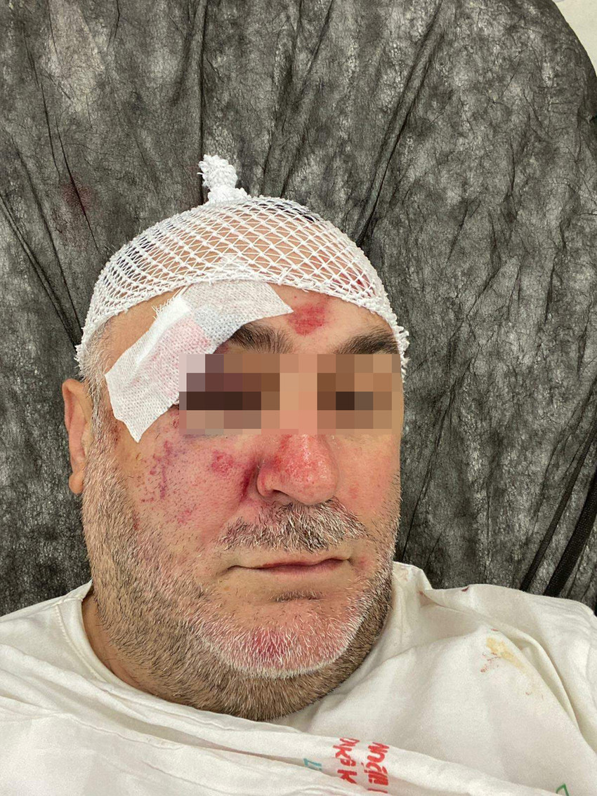 Türkiye'nin turizm başkentlerinden Bodrum'da bir restoran işletmecisi, yanında çalışan bir garson ve arkadaşlarının saldırısına uğradı. Saldırganlar ağır yaraladıkları işletmecinin parasını da gasp etti...