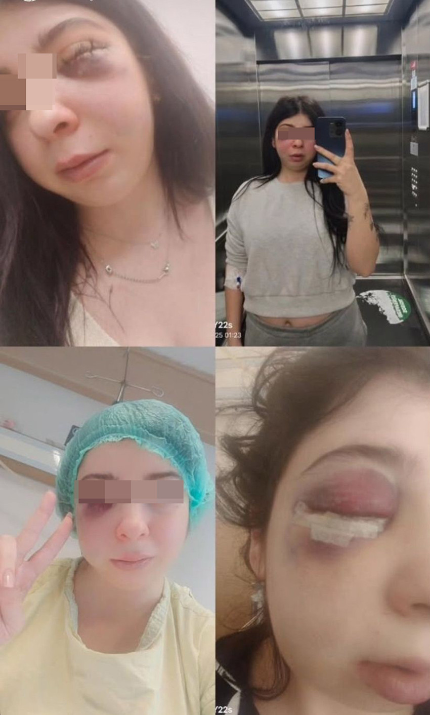 Samsun'da yaşanan korkunç olayda 32 yaşındaki bir genç kadın sokak ortasında hem tacize uğradı hem de darp edildi. Saldırganın hastanelik ettiği genç kadının yüzünde 2 kırık oluştu.