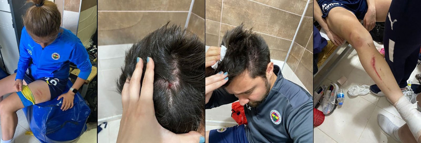 Amedsporlu futbolcular, Fenerbahçelilere saldırdı