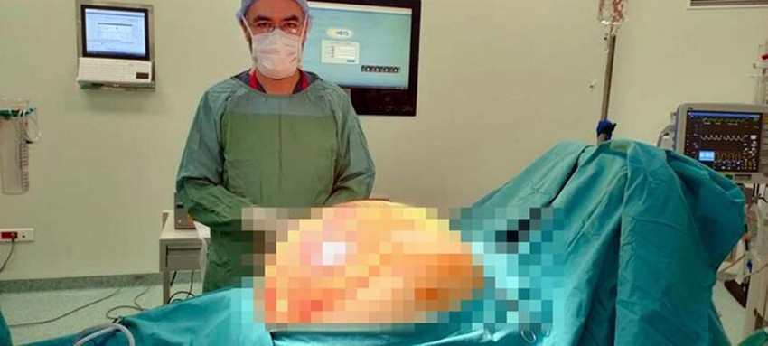 Karın şişliği şikayetiyle gitmişti... Doktorlar ameliyatta neye uğradığını şaşırdı - Resim: 1