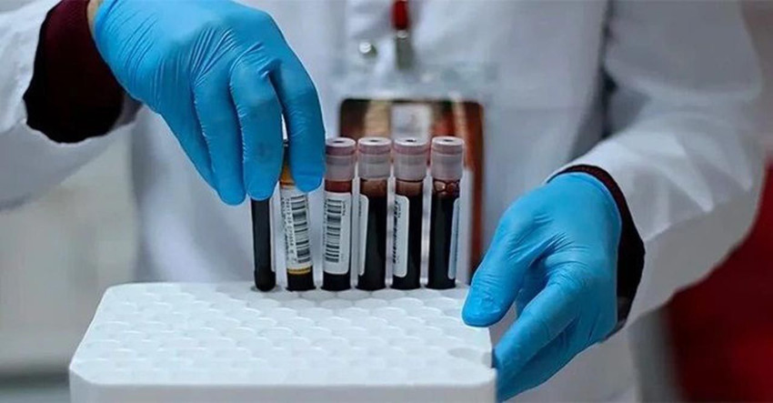 Bilim insanları açıkladı: Bu kan grubuna sahip olanlar dikkat - Resim: 3