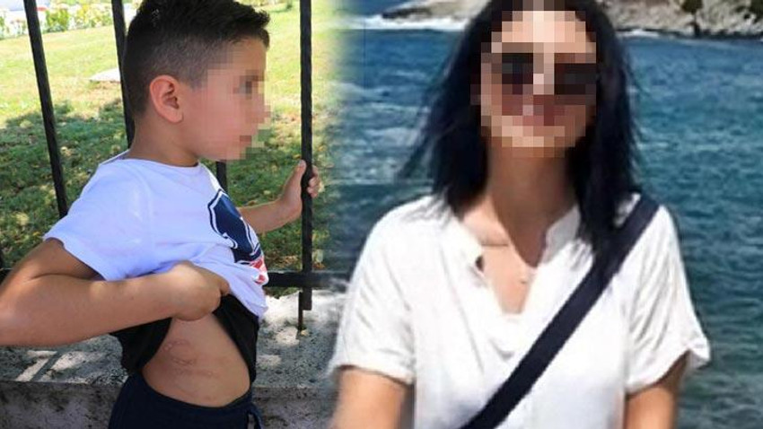 Böyle anne olmaz olsun ! Çocuğuna işkence yaptı...