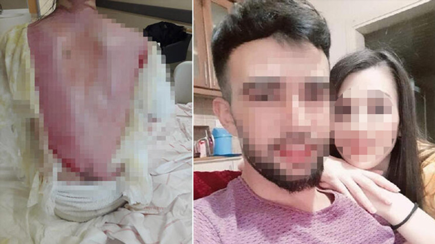 Eşini ve kızını haşlayan koca: Kazara olmuş bir olay