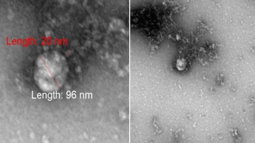 İşte mutasyon geçiren koronavirüsün ilk fotoğrafı