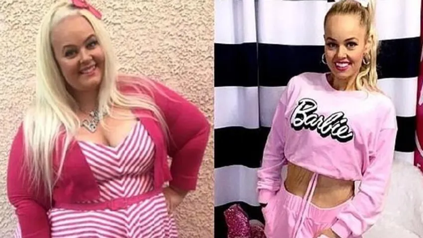 Sosyal medya fenomeni barbie bebeğe benzemek için tam 90 kilo verdi