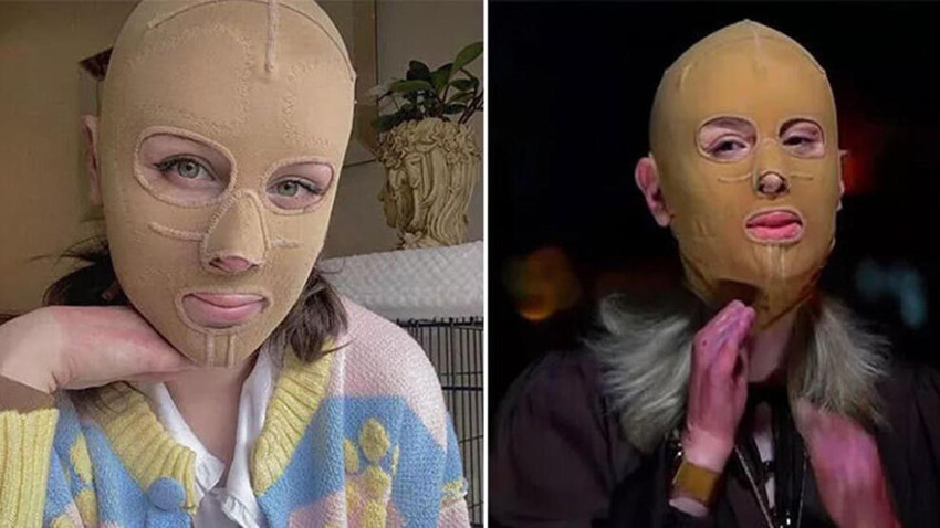 2.5 yıl sonra maskesini çıkardı, acılarını paylaştı - Resim: 1