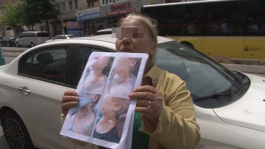 Diş ameliyatı için gitti; gözünü yoğun bakımda açtı - Resim: 1
