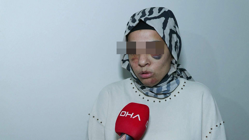 Kadına şiddetin son adresi İstanbul Bağcılar oldu. Eşinden boşanan 35 yaşındaki 2 çocuk annesi genç kadın, eski eşinin ailesi tarafından sokak ortasında sopalarla dövüldü. 