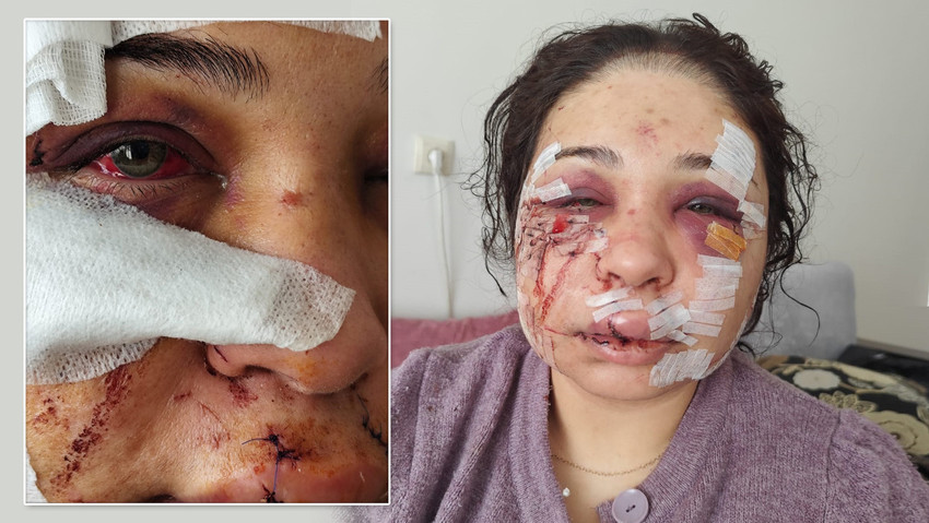 Boşanma aşamasındaki 3 &ccedil;ocuk annesi eşine şiddet uyguladığı tespit edilen Cumhurbaşkanı Koruma Dairesi personeli tutuklandı.