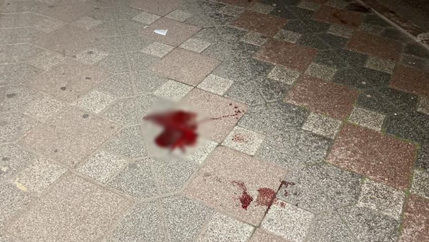 Kocaeli'nin Gebze ilçesinde kız meselesi sebebiyle çıktığı iddia edilen kavgada göğsünden tabancayla vurulan 16 yaşındaki genç hayatını kaybetti.
