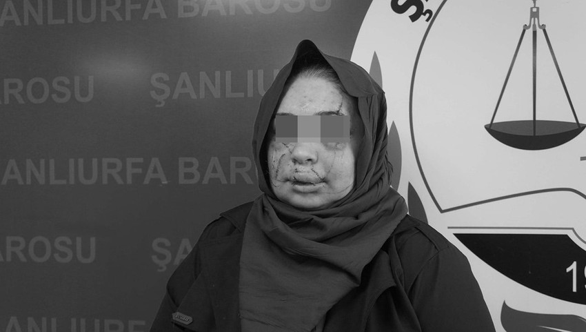 Boşanma aşamasındaki 3 &ccedil;ocuk annesi eşine şiddet uyguladığı tespit edilen Cumhurbaşkanı Koruma Dairesi personeli tutuklandı.