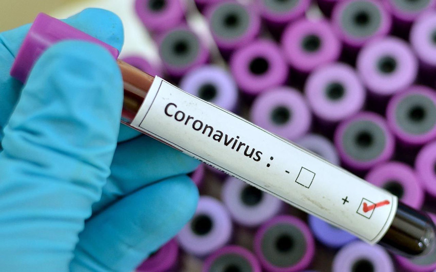 Koronavirüs Bilim Kurulu üyesinden ''Pirola varyantı'' uyarısı - Resim: 4