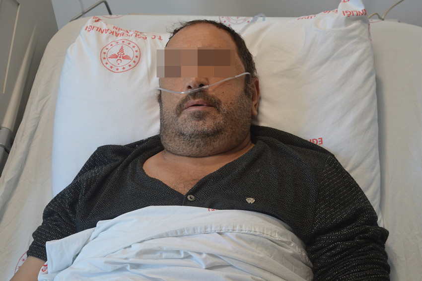 Mardin'de 50 yaşındaki bir vatandaş, nefes almakta zorlandığı şikayetiyle başvurduğu hastanede v&uuml;cudundan tam 6 kilo ağırlığında ve 36 santimetre uzunluğundaki b&ouml;breği alınarak hayata geri d&ouml;nd&uuml;...