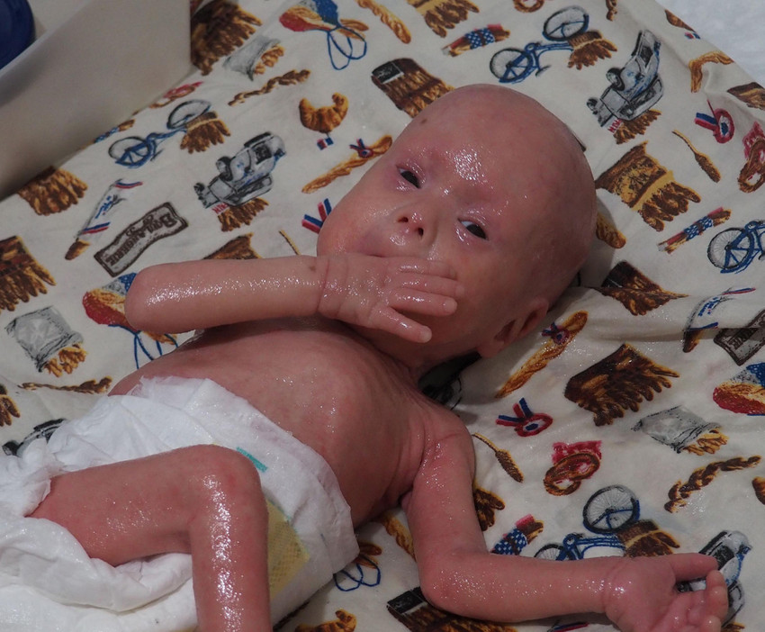 Çıplak elle dokunmak yasak: ''Yılan bebek'' 1 yaşında - Resim : 1