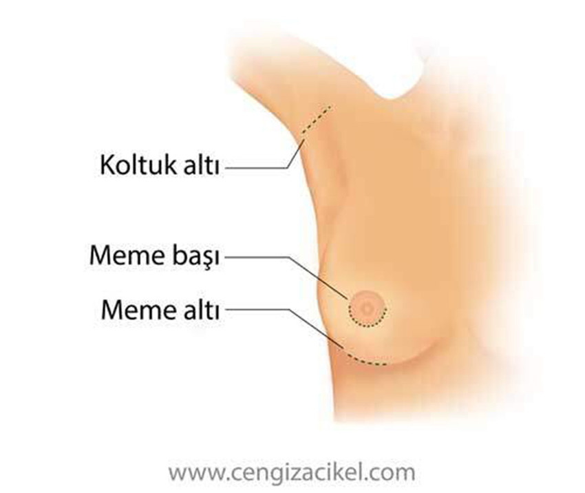 Meme estetiği, kadınların meme boyutlarında ve estetik görünümlerindeki anormallikleri düzeltmeye, memelere ideal şekli ve büyüklüğü vermeye yönelik gerçekleştirilen bir dizi farklı estetik ameliyata verilen genel isimdir. 