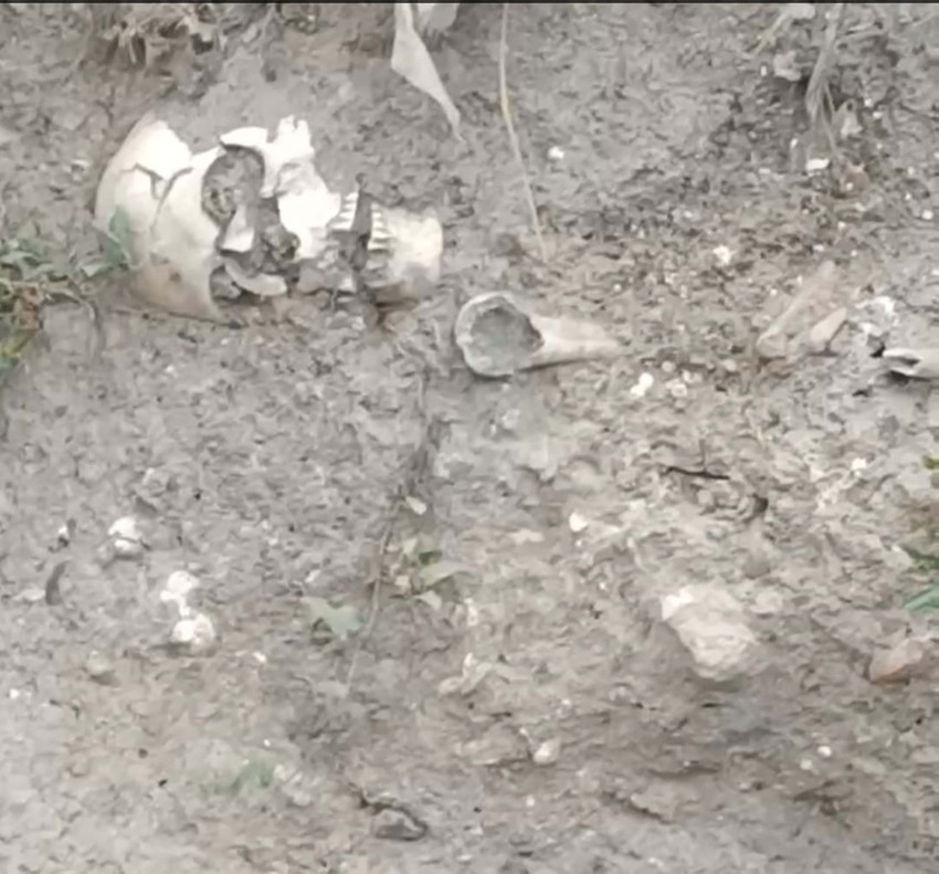 Çankırı'da kafatası ve kemikler bulundu - Resim : 1