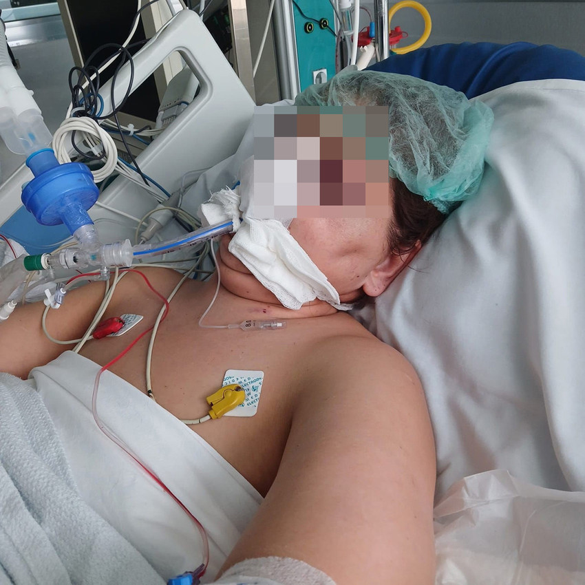 Kayseri'de burun, elmacık kemiği ve kulaklarından estetik ameliyat geçiren 3 çocuk annesi kadının operasyonlardan 5 gün sonra hastanede hayatını kaybetmesinin ardından ailesi hastaneden şikayetçi oldu. Hayatını kaybeden kadının ailesi "ameliyatına profesör girecekken, asistanı girmiş" iddiasında bulundu.